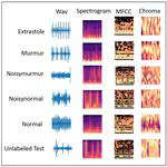 SpectroHeart